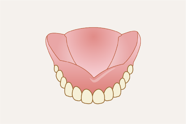 保険診療の入れ歯イメージ