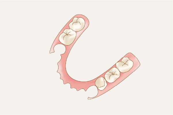 フレキシブルデンチャーのイメージ