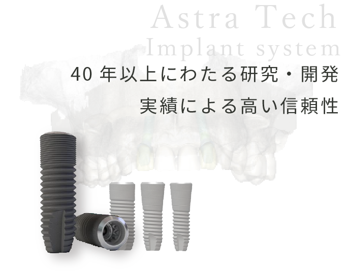 インプラントのイメージ