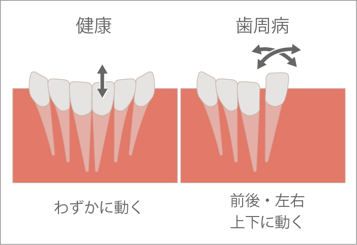 動揺度検査イメージ