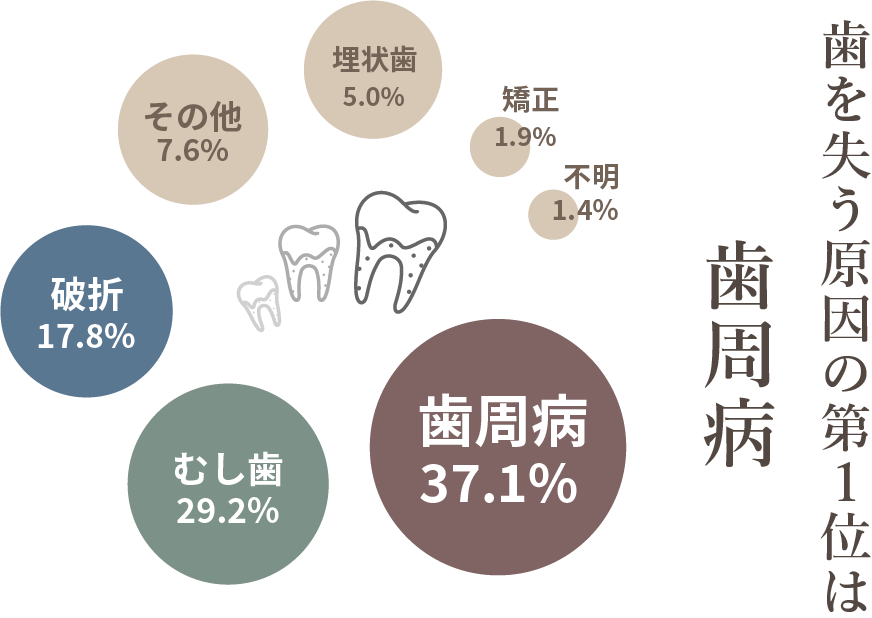 歯を失う原因の1位は歯周病